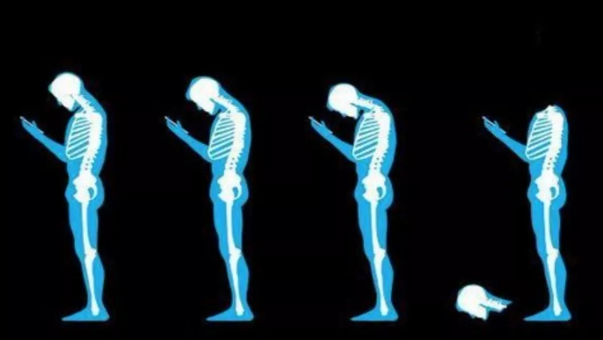 Text Neck: Is your smartphone wrecking your spine?